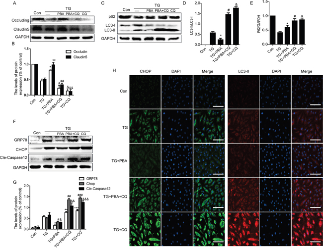 Chloroquine treatment abolishes the role of 4-PBA on ER stress and TJ proteins in vitro.