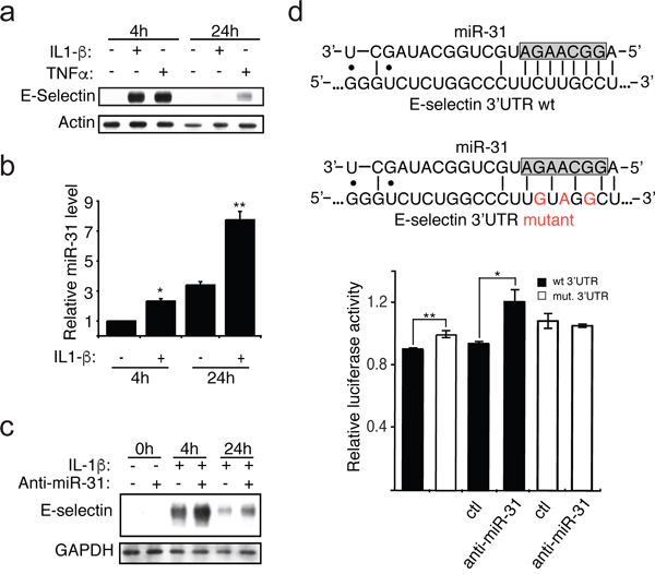IL-1&#x03B2; induces the expression of miR-31, which affects E-selectin abundance.