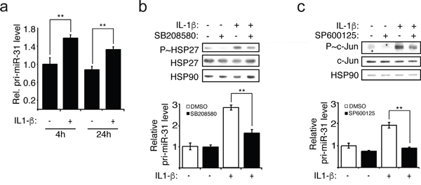 IL-1&#x03B2; induces the transcription of miR-31 via p38 and JNK.
