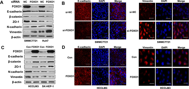 FOXO1 reverses EMT in HCC cells.