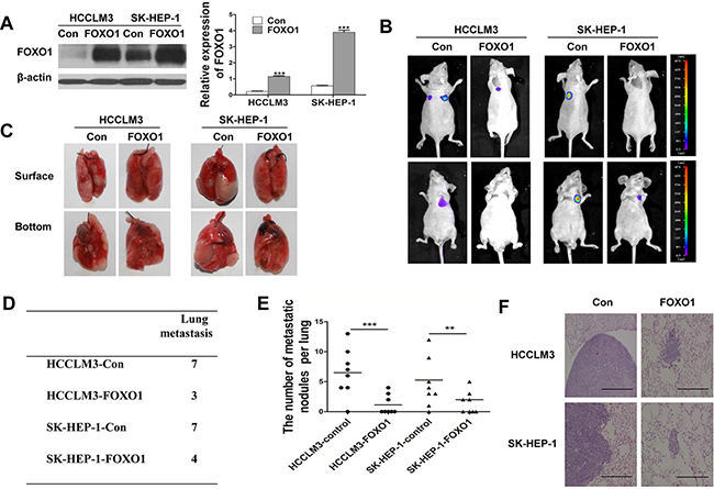 FOXO1 overexpression in luciferase-labeled HCCLM3 and SK-HEP-1 cells inhibits lung metastasis.