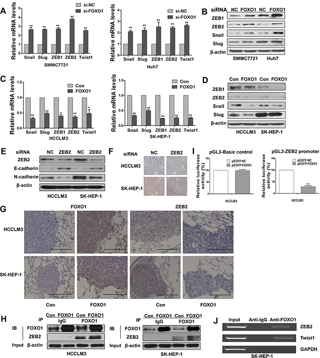 Functional effects of FOXO1 on EMT-inducing transcription factors.