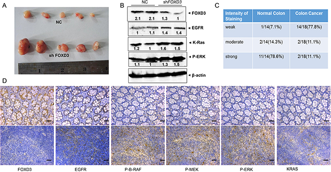 FOXD3 inhibited EGFR/Ras/Raf/MEK/ERK signal pathway in xenograft tumor and human samples.