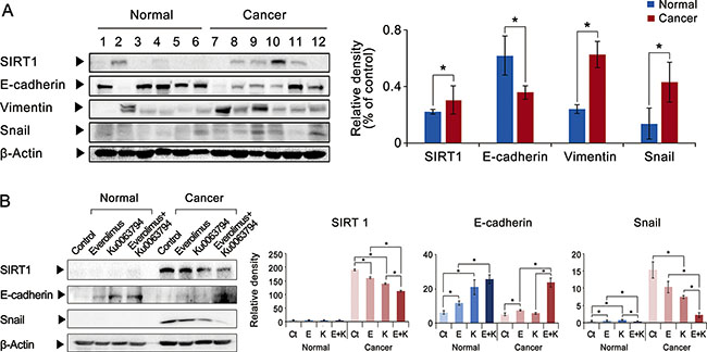 Effects of everolimus, Ku0063794, and their combination on the expression of SIRT1 and EMT markers in the ex vivo model of HCCs.