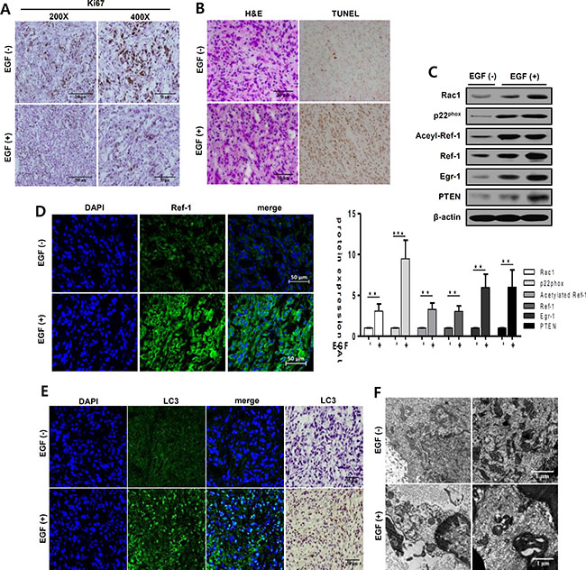 EGF increases apoptosis and autophagy in xenograft tumors.