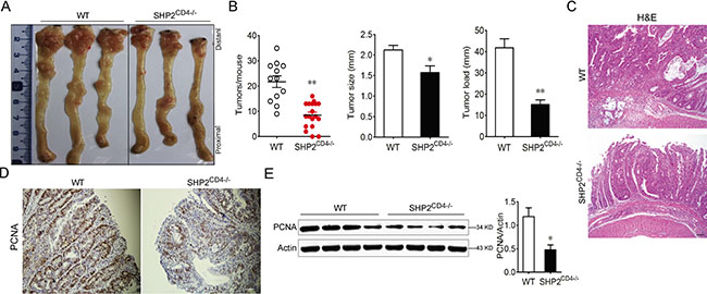 SHP2-deficiency leads to decreased development of colitis-associated colon (CAC) cancer.