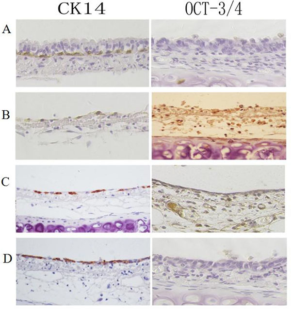 Immunohistochemical analysis of Oct3/4 and CK14 expression during rat tracheal epithelium recovery after 5-FU-induced injury.