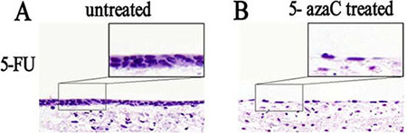 Analysis of the morphological effects of 5-azaC treatment on rat tracheal epithelium repair by HE staining.