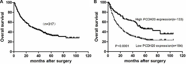 Kaplan-Meier curves for overall survival of hepatocellular carcinoma patients after surgical resection.