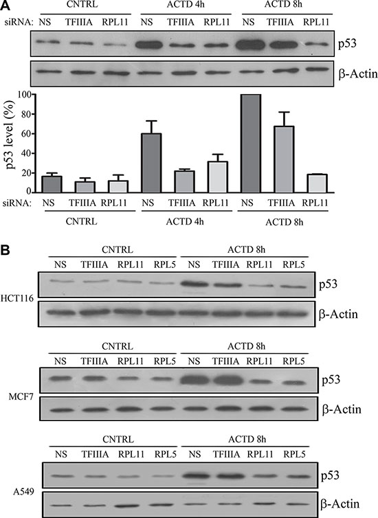 5S rRNA neosynthesis inhibition do not efficiently abrogates p53 stabilization after inhibition of ribosome biogenesis.