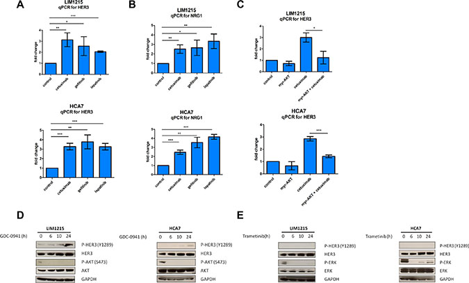 HER3 mRNA induction by cetuximab is blocked by AKT overexpression.