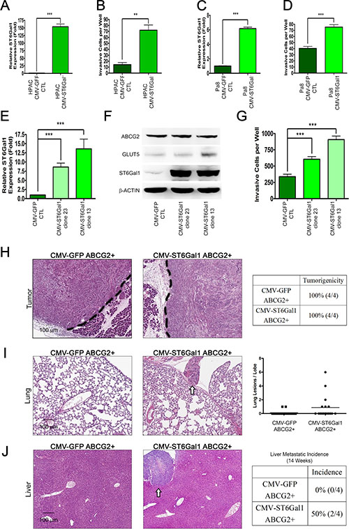ST6Gal1 overexpression triggers pancreatic cancer metastasis.