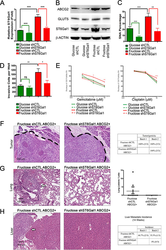 ST6Gal1 knockdown is sufficient to inhibit pancreatic cancer metastasis.