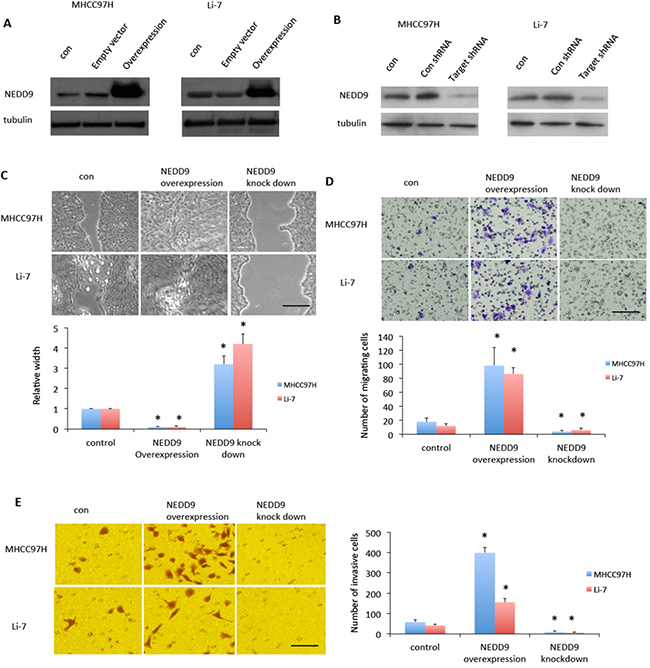 NEDD9 regulated hepatocellular carcinoma cells migration and invasion.