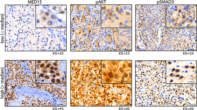 Protein expression of MED15, pAKT and pSMAD3.