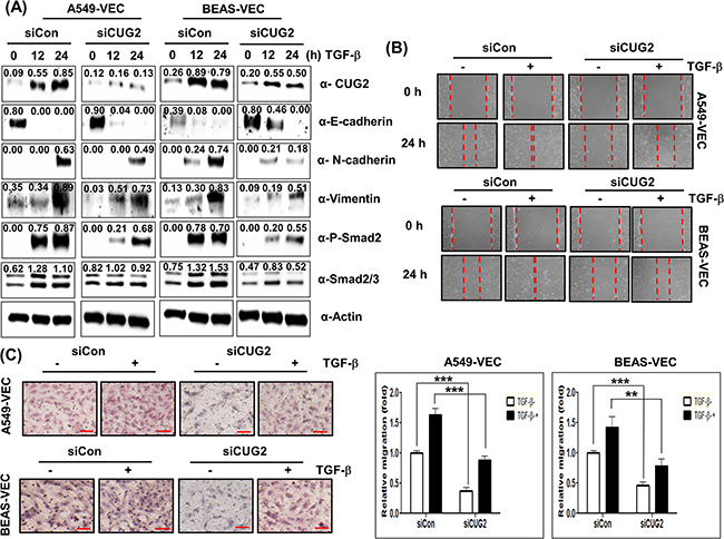 CUG2 is partially involved in TGF-&#x03B2;-mediated EMT.