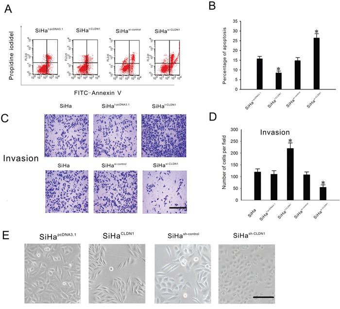 Effects of the inhibition of CLDN1 expression on apoptosis, invasion and cellular transformation in SiHa cells.