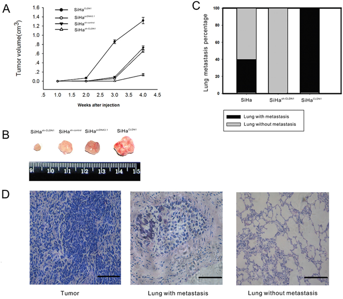 Overexpression CLDN1 prompts tumor growth and lung metastasis in vivo.