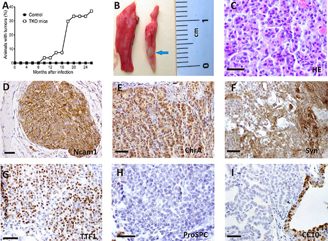 Spontaneous tumorlet development after ablation of Rb family members in adult TKO lungs.