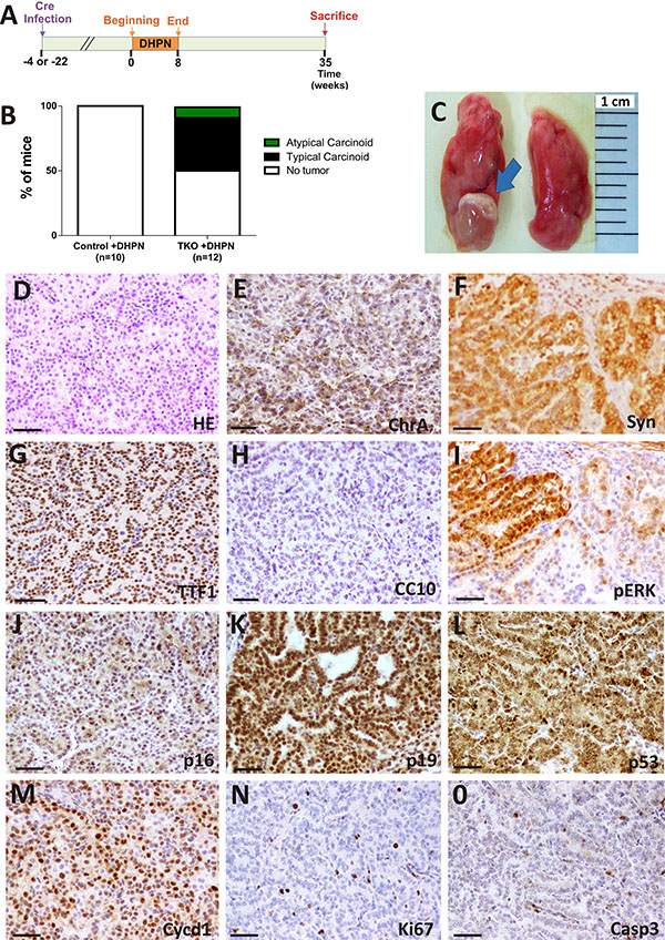 DHPN carcinogenesis in TKO mice.
