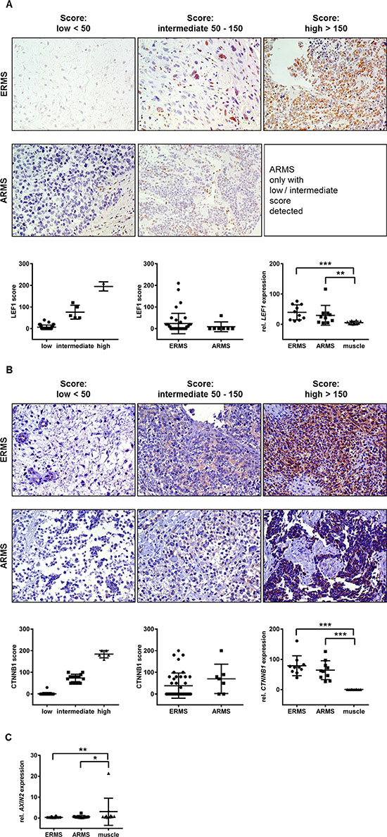 Immunohistochemical and/or qRT-PCR analyses of LEF1, &#x03B2;-catenin and AXIN2 in human ERMS and fusion-positive ARMS.