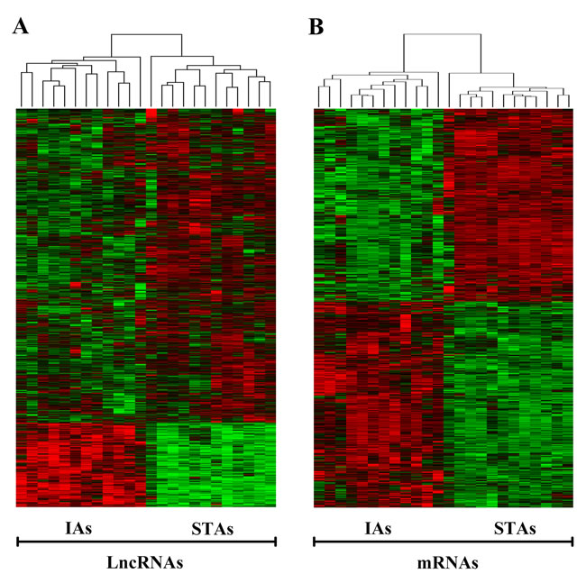 Heat map of differentially expressed lncRNAs and mRNAs of IAs and STAs.