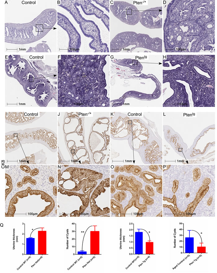 Genetic alterations in Pten, a negative regulator of mTOR signaling, contribute to the hyperplastic growth of uterus.