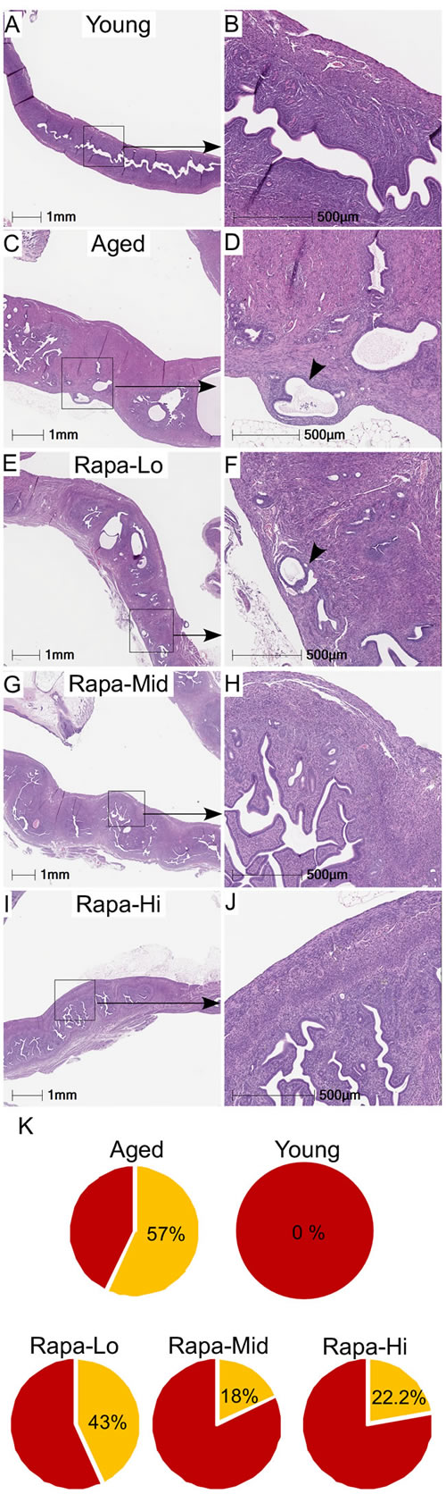 Chronic rapamycin treatment suppresses age-associated hyperplastic changes in the mouse uterus.