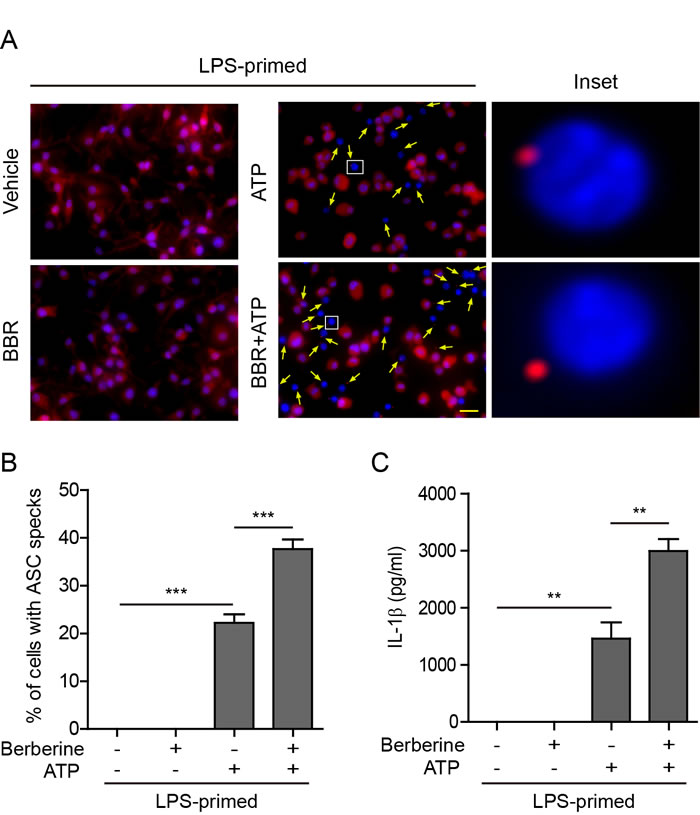 Berberine increased ATP-induced ASC speck formation and IL-1&#x3b2; release in bone marrow-derived macrophages (BMDMs).