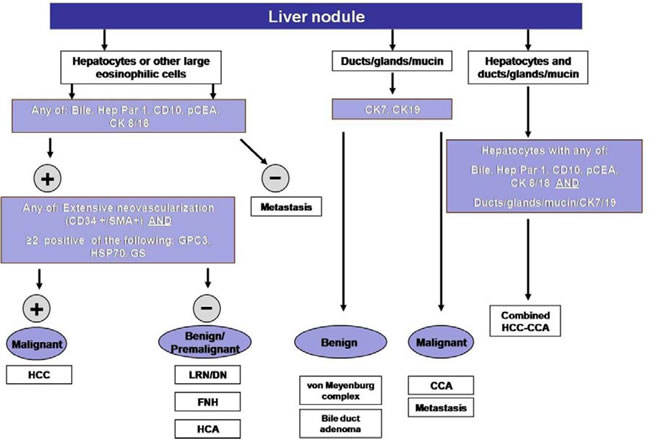 Simplified diagnostic algorithm in the pathologic evaluation of liver nodules.