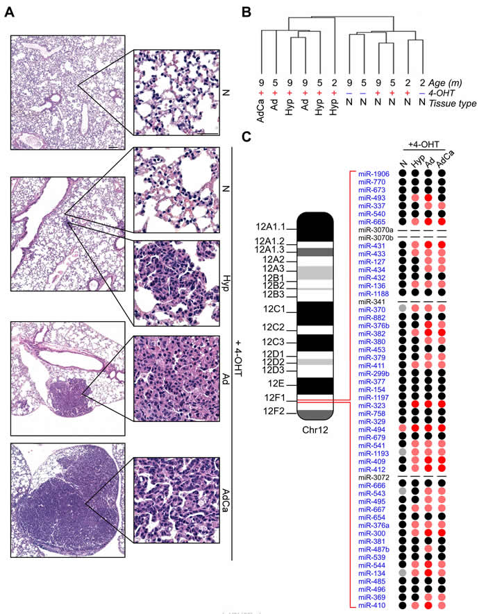 Overexpression of chr.12qF1 miRNAs during lung carcinogenesis in the K-Ras