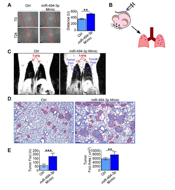 miR-494-3p enhanced lung cancer cells motility