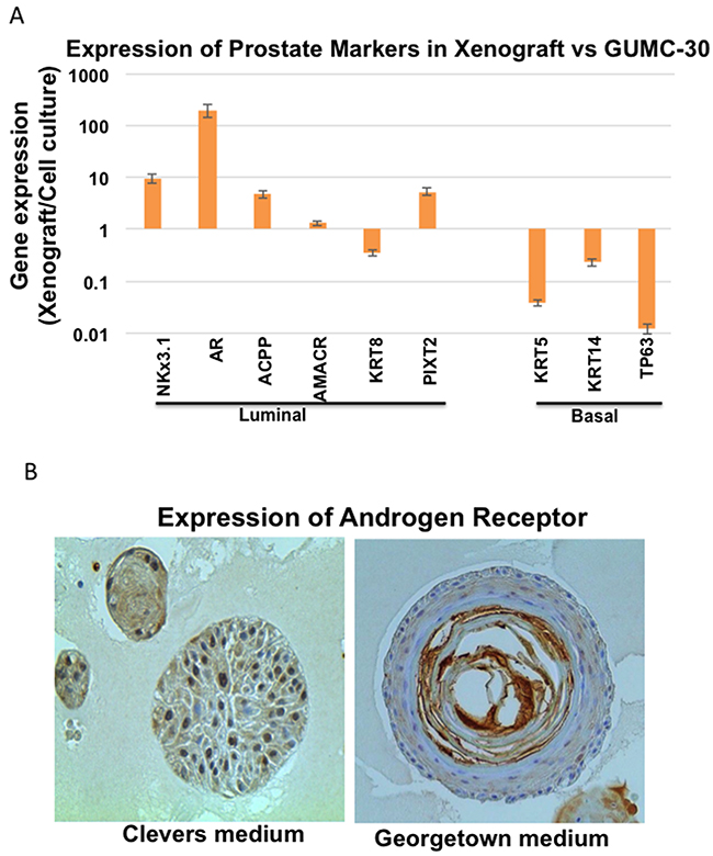 Differential gene expression in tumor CRs and xenografted tumor.