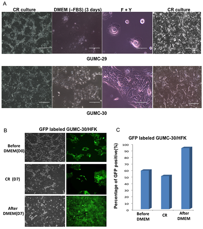 Selection of Tumor CR cells.