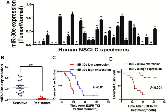 MiR-30e expression is markedlyreduced in lung cancer.