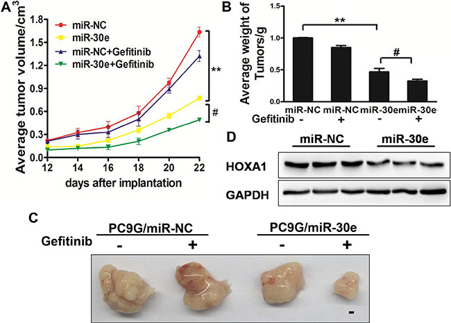 MiR-30e enhances chemosensitivitytogefitinib in a mouse model.