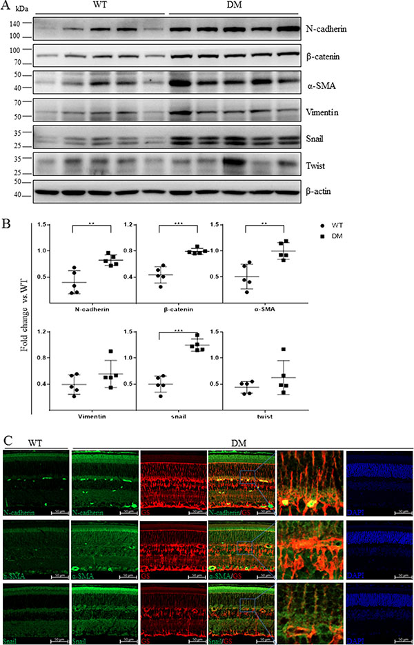 Mesenchymal marker expression was increased in the retinas of STZ-diabetic mice.