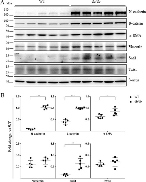 Mesenchymal marker expression was increased in the retinas of db/db mice.