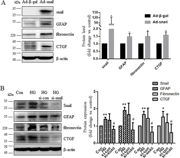 Snail increased CTGF and fibronectin expression in M&#x00FC;ller cells.