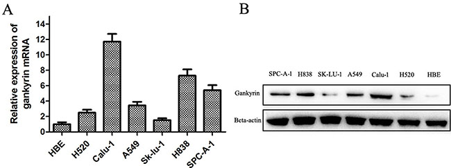 Gankyrin mRNA and protein expressions in six human NSCLC and normal bronchial epithelium cell lines.