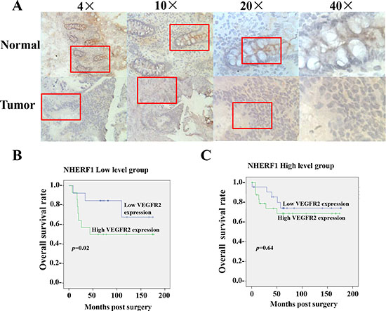 Prognosis value of VEGFR2 expression in colorectal cancer relied on the expression of NHERF1.