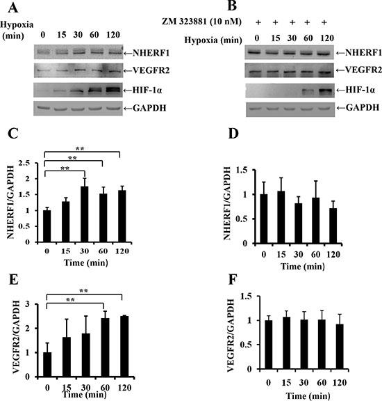 Exposure to hypoxia increased NHERF1 expression depending on the activation of VEGFR2 signaling pathway.
