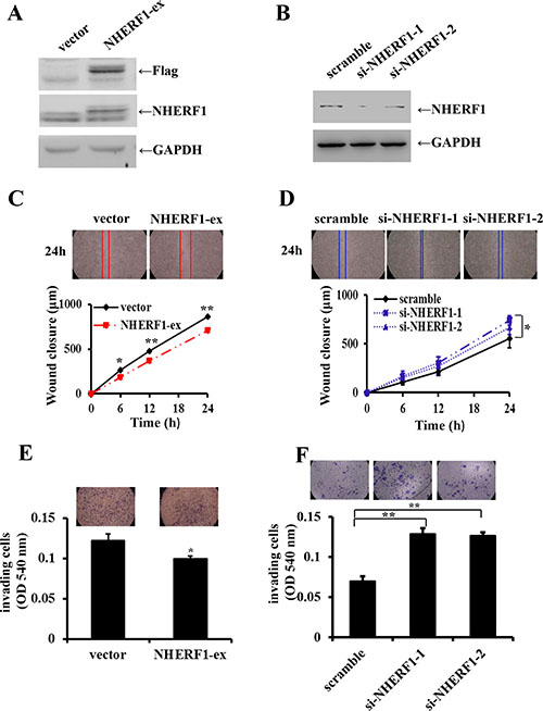 Effects of NHERF1 expression on the migration and invasion of RKO cells.