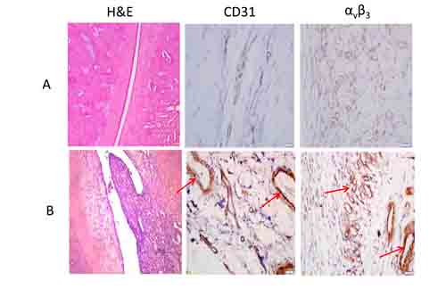 Histological changes matched to