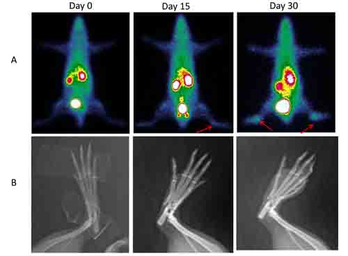 Temporal changes in rheumatoid arthritis monitored by serial