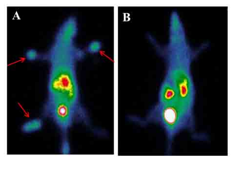 Bevacizumab reduces uptake of