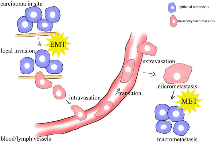schematic mode of the sites of EMT/MET in the metastasis of cancer.