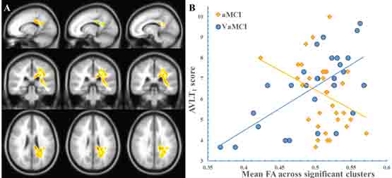 The &#x201c;FA &times; Group&#x201d; interaction effect on the AVLT
