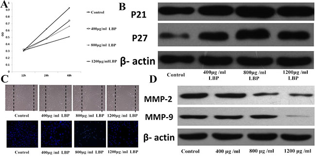 LBP can inhibit the proliferation and migration of BIU 87cells.
