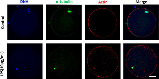 Actin assembly was not disrupted following lipopolysaccharide treatment.